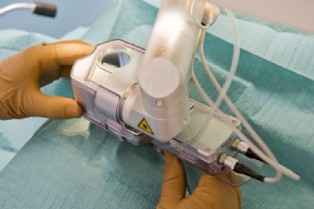 Laserchirurgie